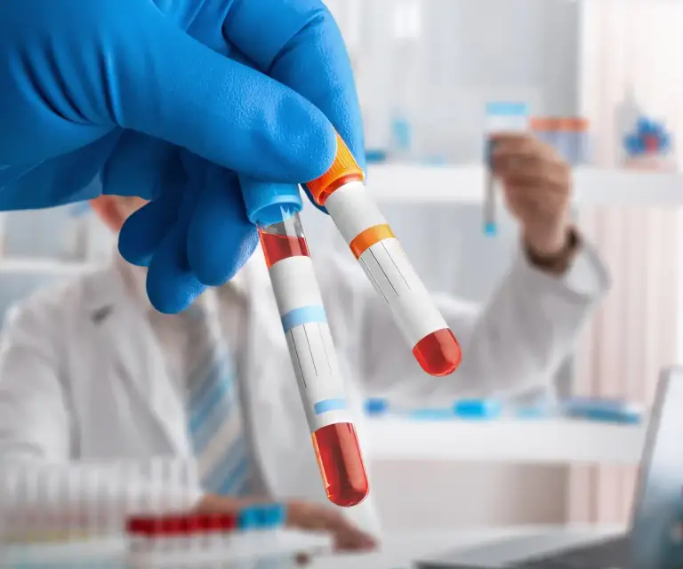 Lab Test Support With Blood Samples